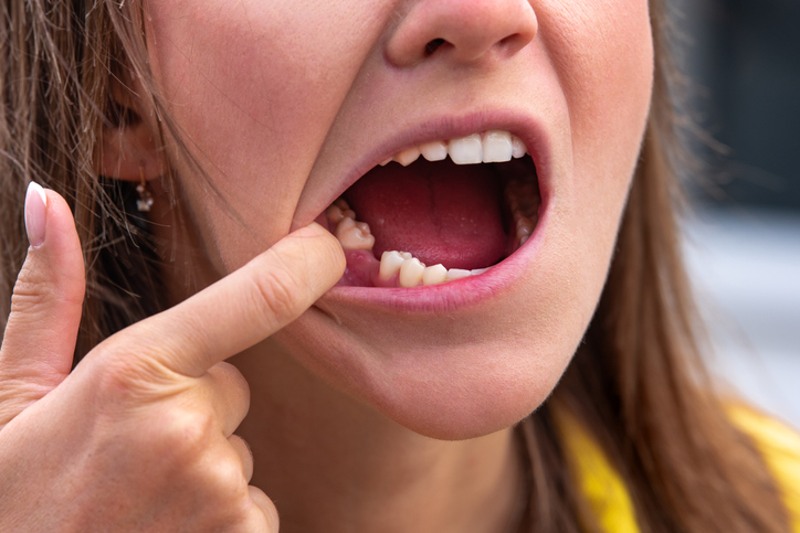 dental assistant training